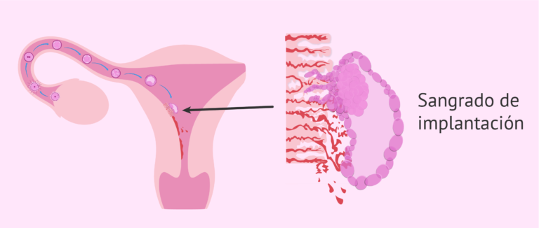 el blastocisto se implanta en la pared utero gif